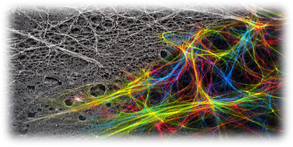 Matrix-Bound Nanovesicles (MBV)